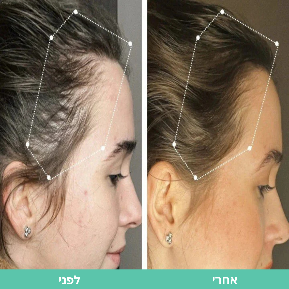 Shifaa™ סרום לצמיחת שיער