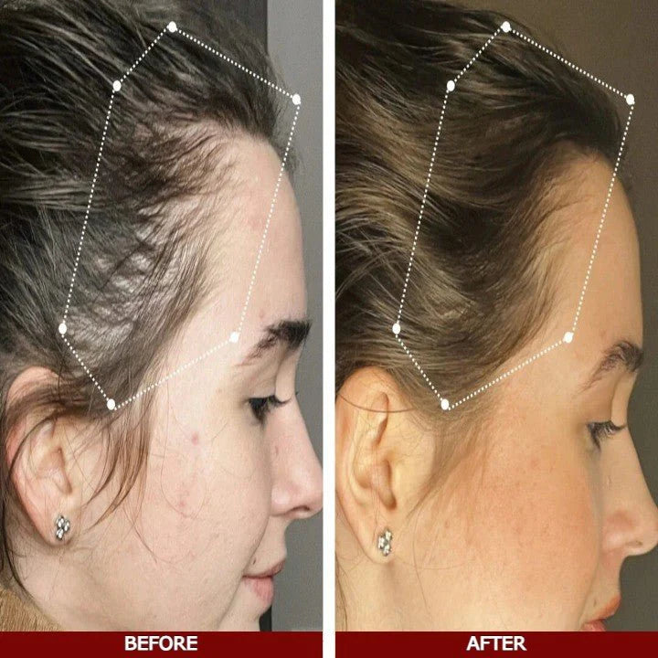 Shifaa™ סרום לצמיחת שיער