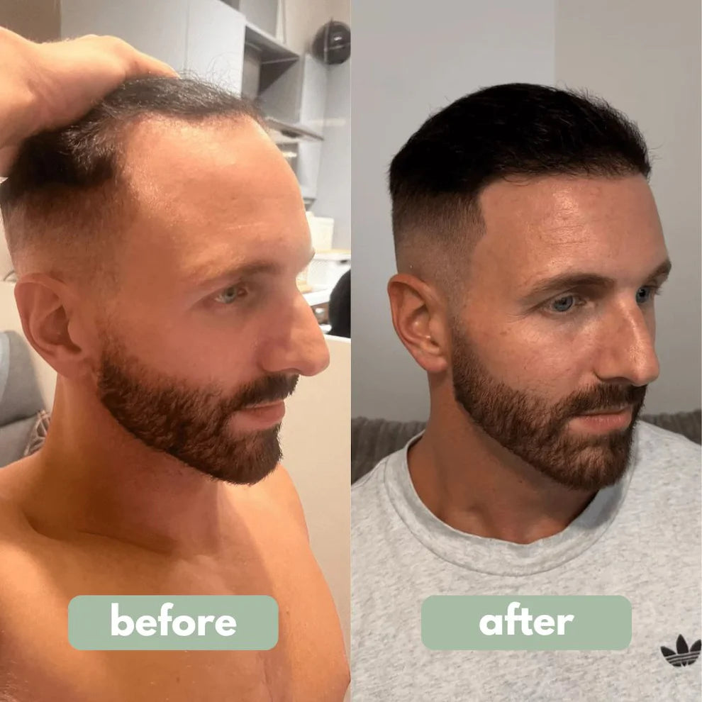 Shifaa™ סרום לצמיחת שיער