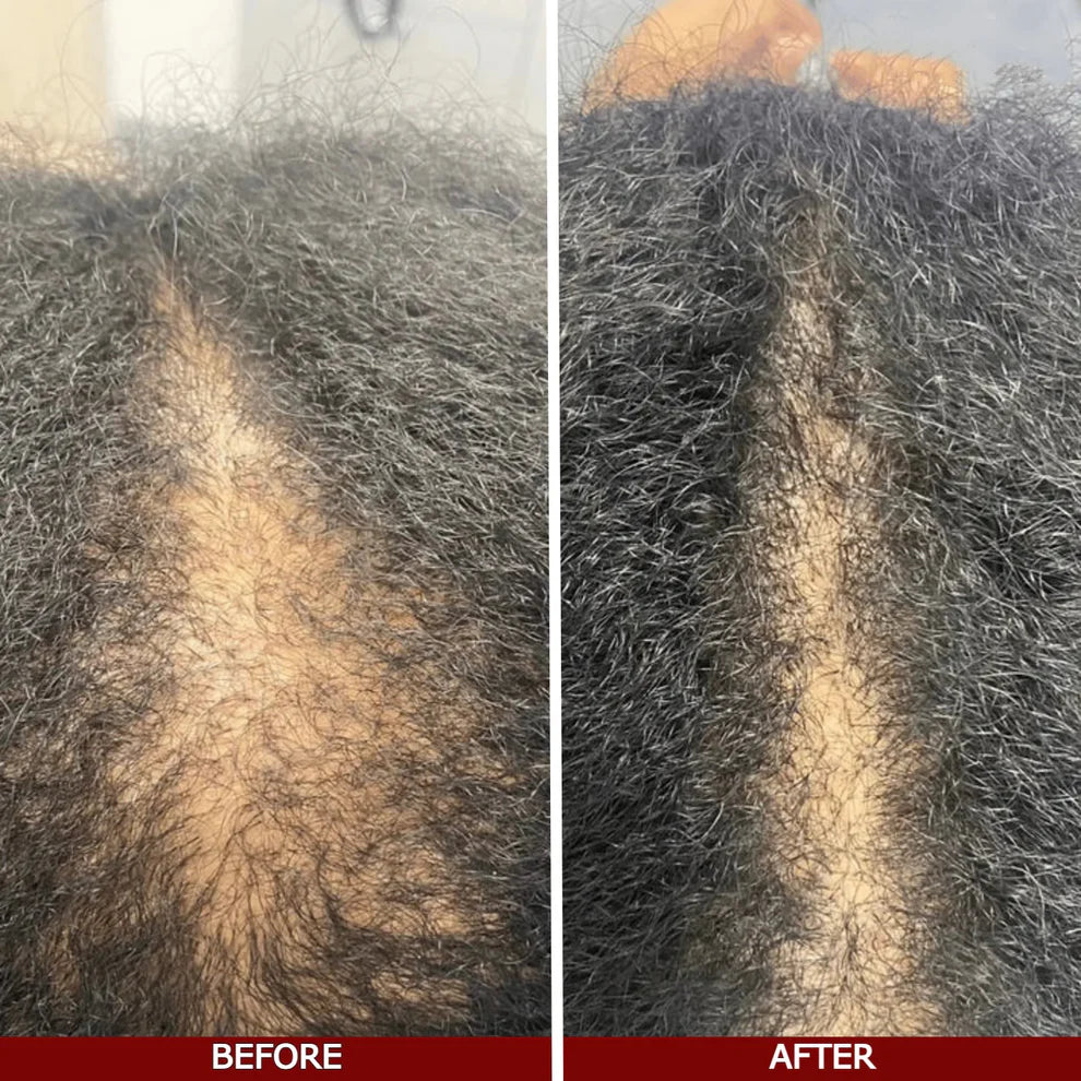 Shifaa™ סרום לצמיחת שיער